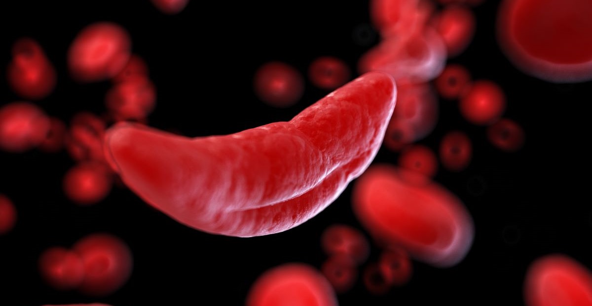 Speckle Plethysmography Vascular Stiffness